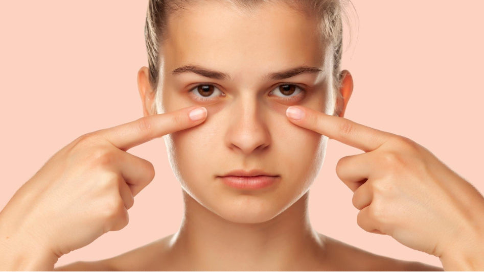 Are your dark circles due to pigmentation ?